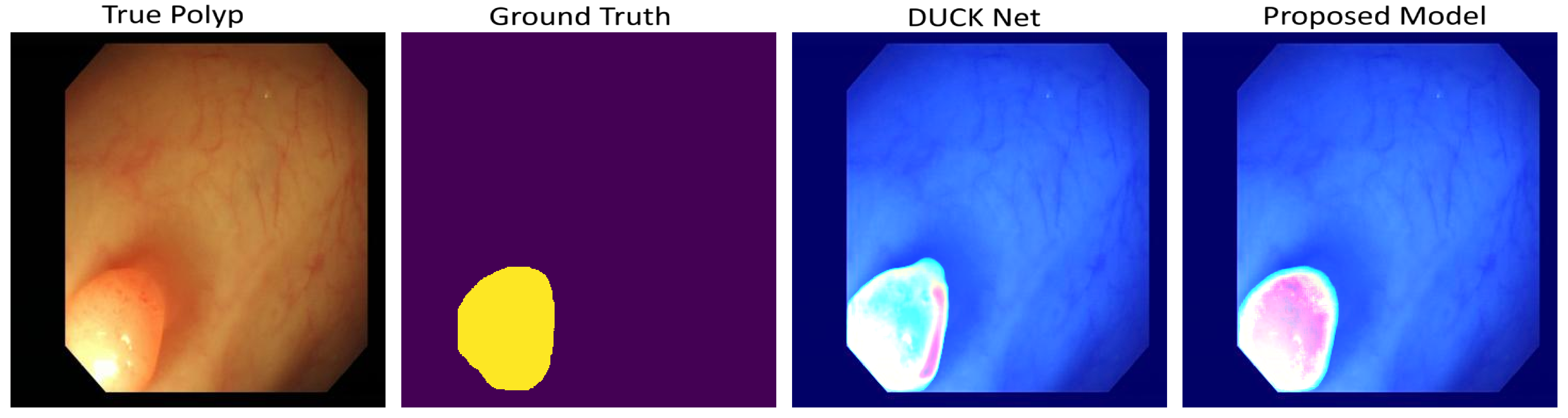 GradCam Visualization