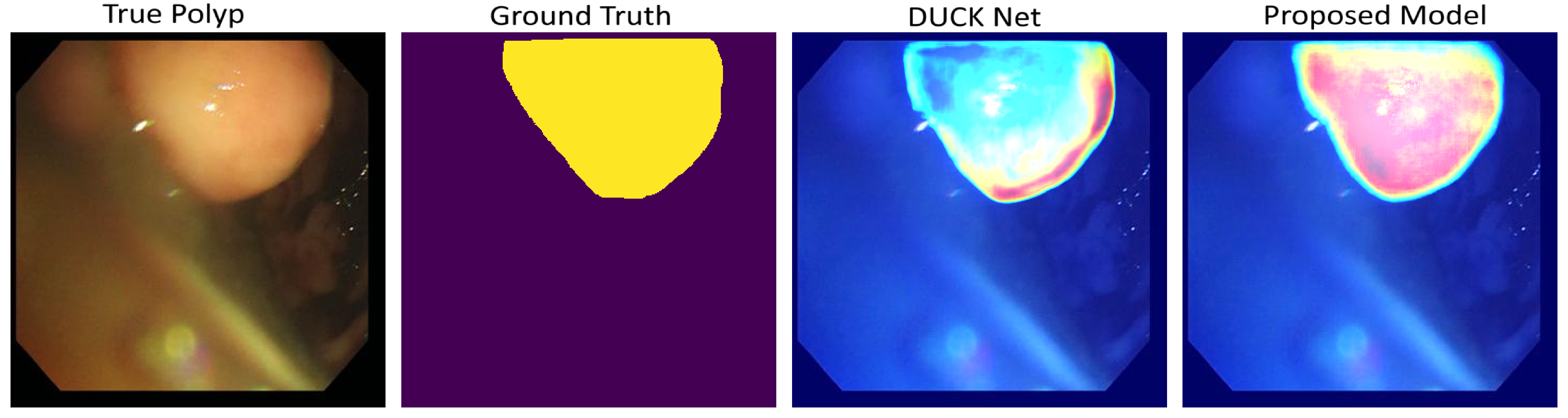 GradCam Visualization