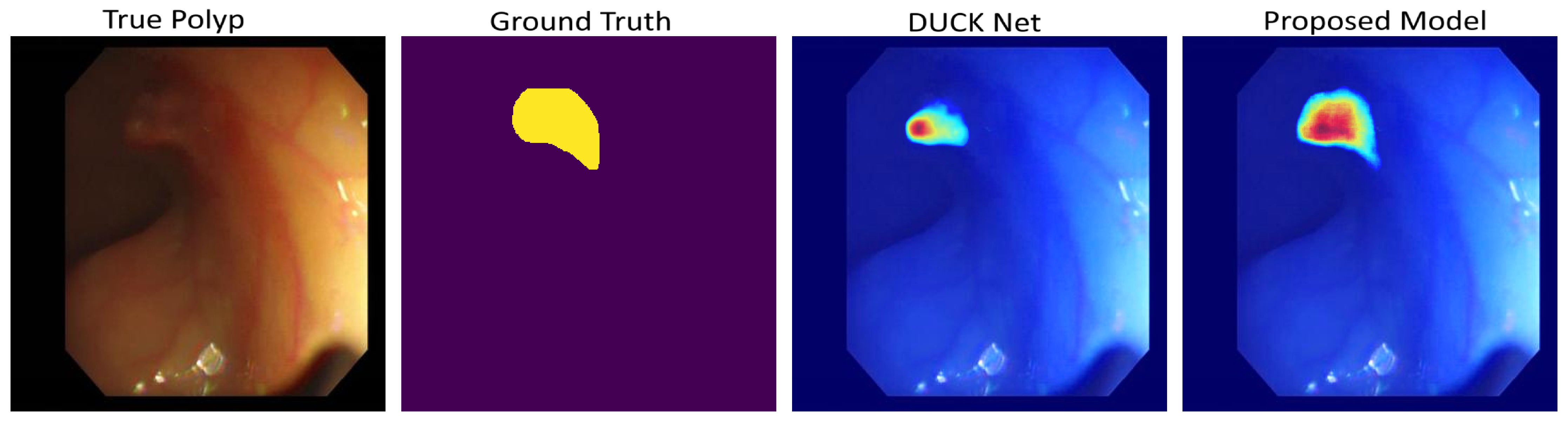 GradCam Visualization