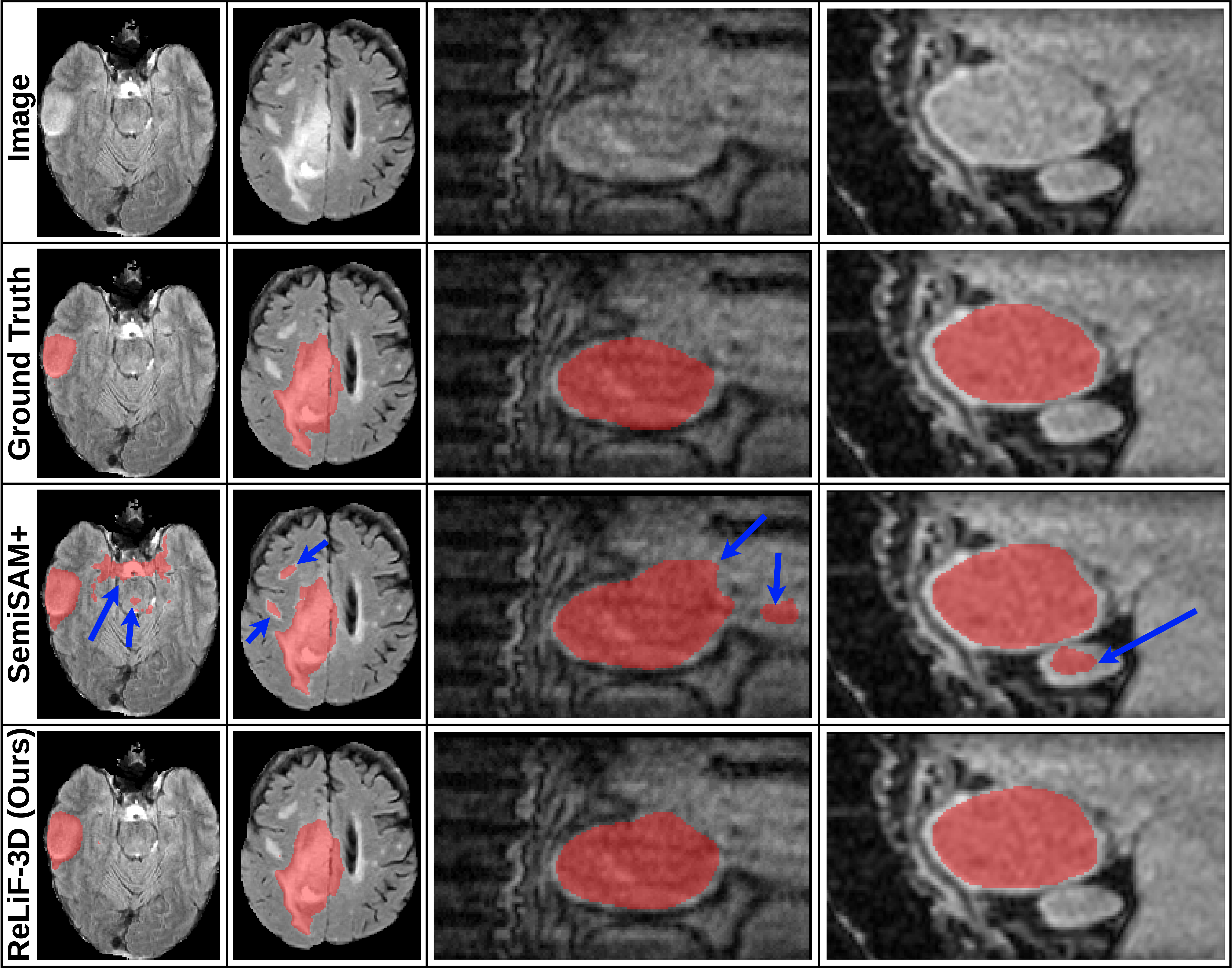 Segmentation comparison between ReLiF-3D, SemiSAM+, ground truth, and input MRI image
