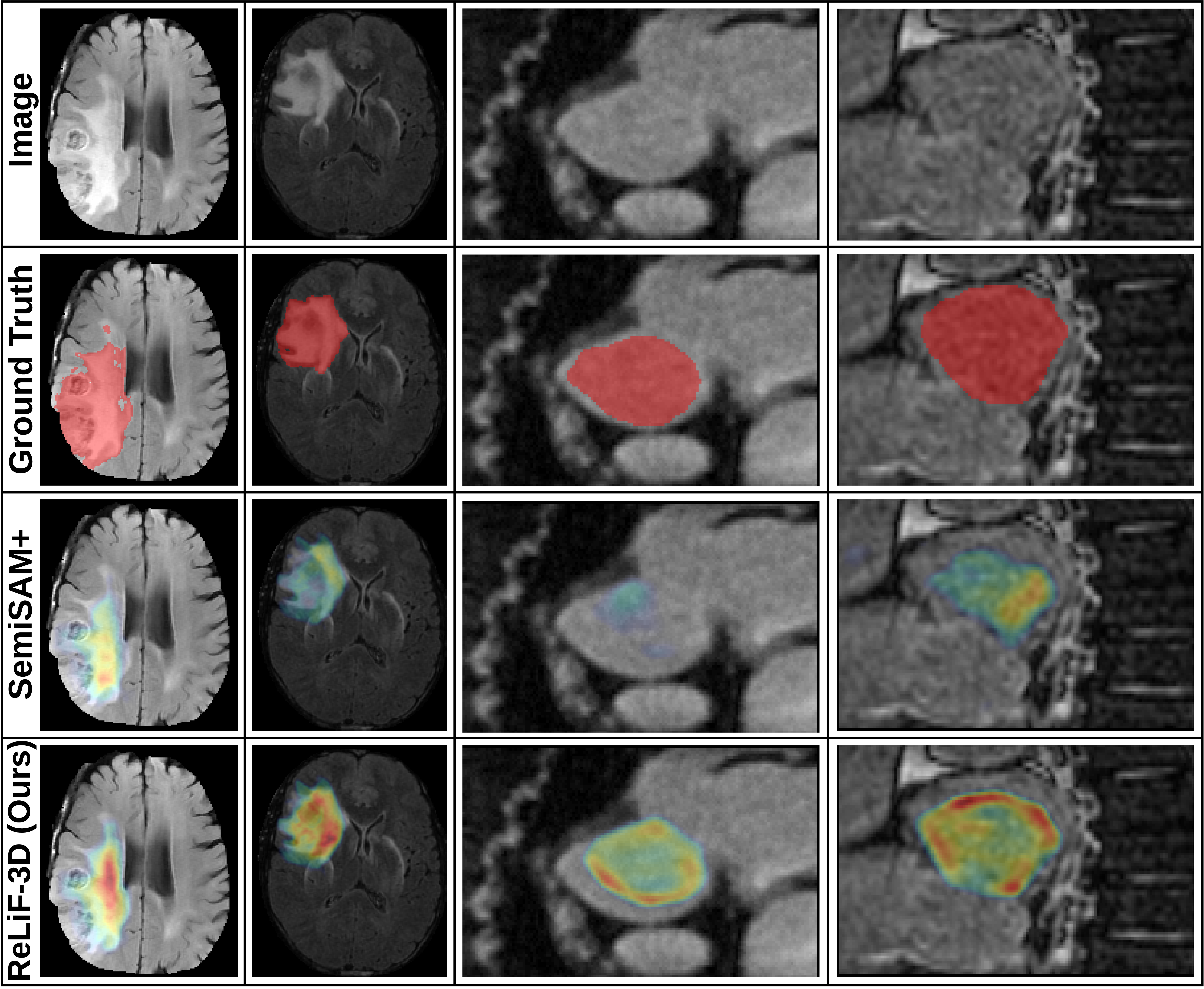 Grad-CAM visualization comparing ReLiF-3D and SemiSAM+ against ground truth